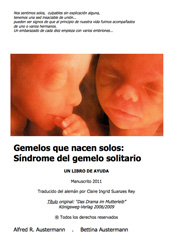 Gemelos que nacen solos:  Síndrome del gemelo solitario 
